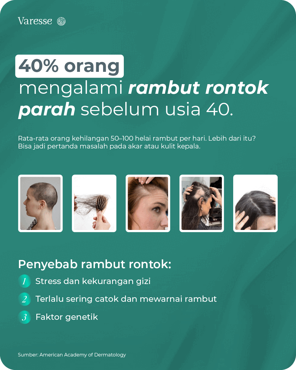 Masalah rambut rontok