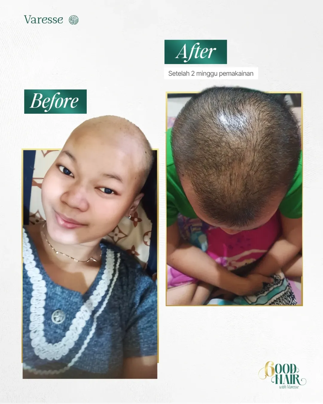 Cancer Survivor 2, testimoni Varesse