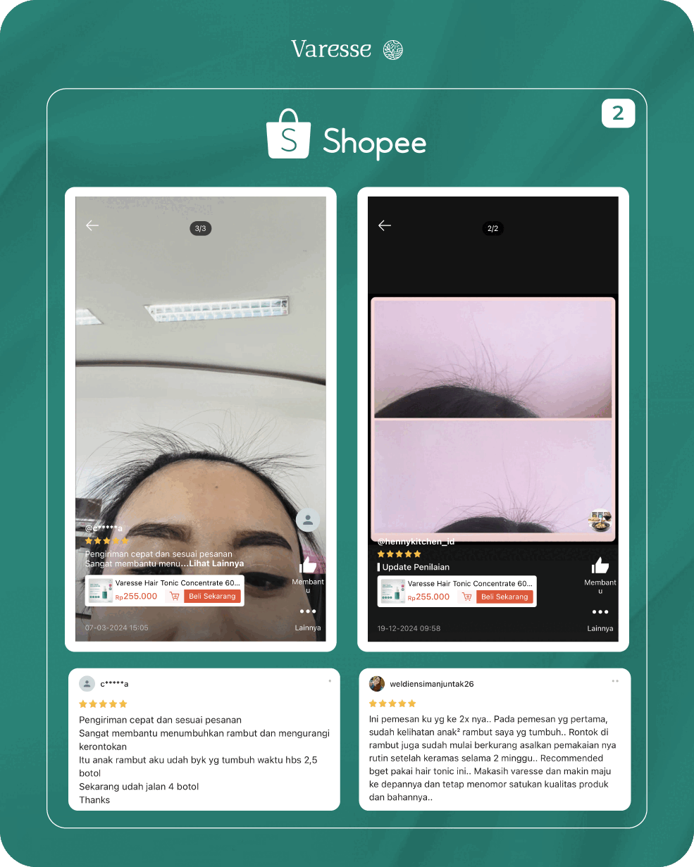 Testimoni Konsumen Shopee 2