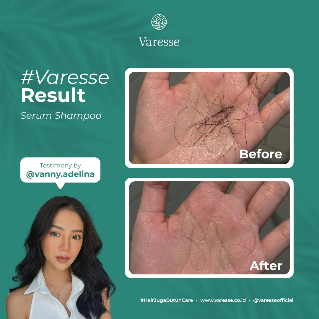 Hasil penggunaan Varesse Serum Shampoo