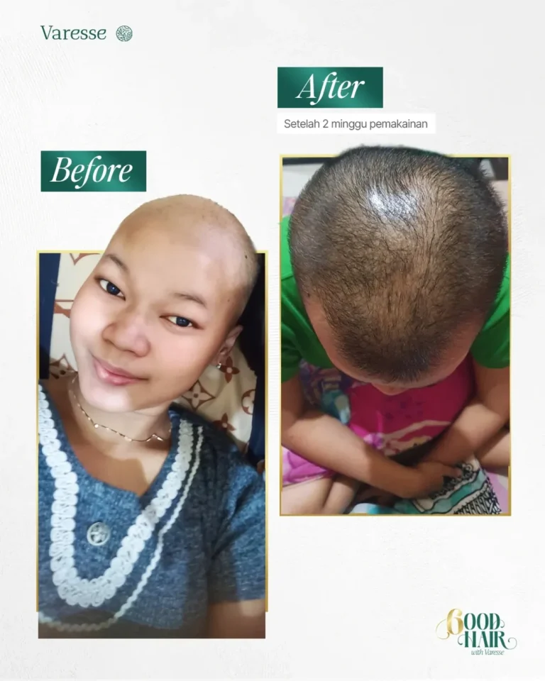 Cancer Survivor 2